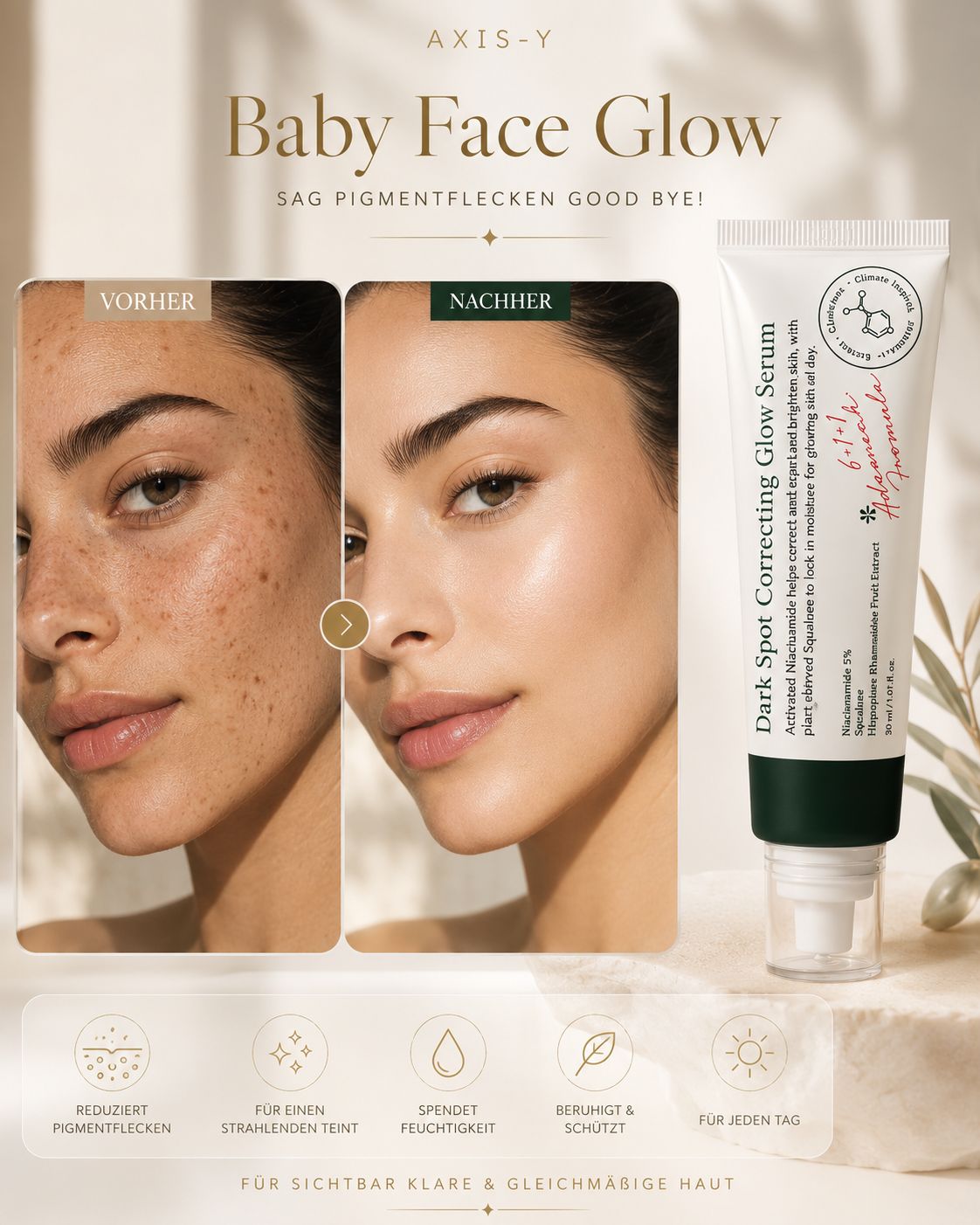 Dunkle Flecken korrigierendes Glow-Serum hellt Pigmentflecken auf, 5 % Niacinamid-Essenz, entfernt dunkle Flecken, Feuchtigkeitscreme, Hautpflege